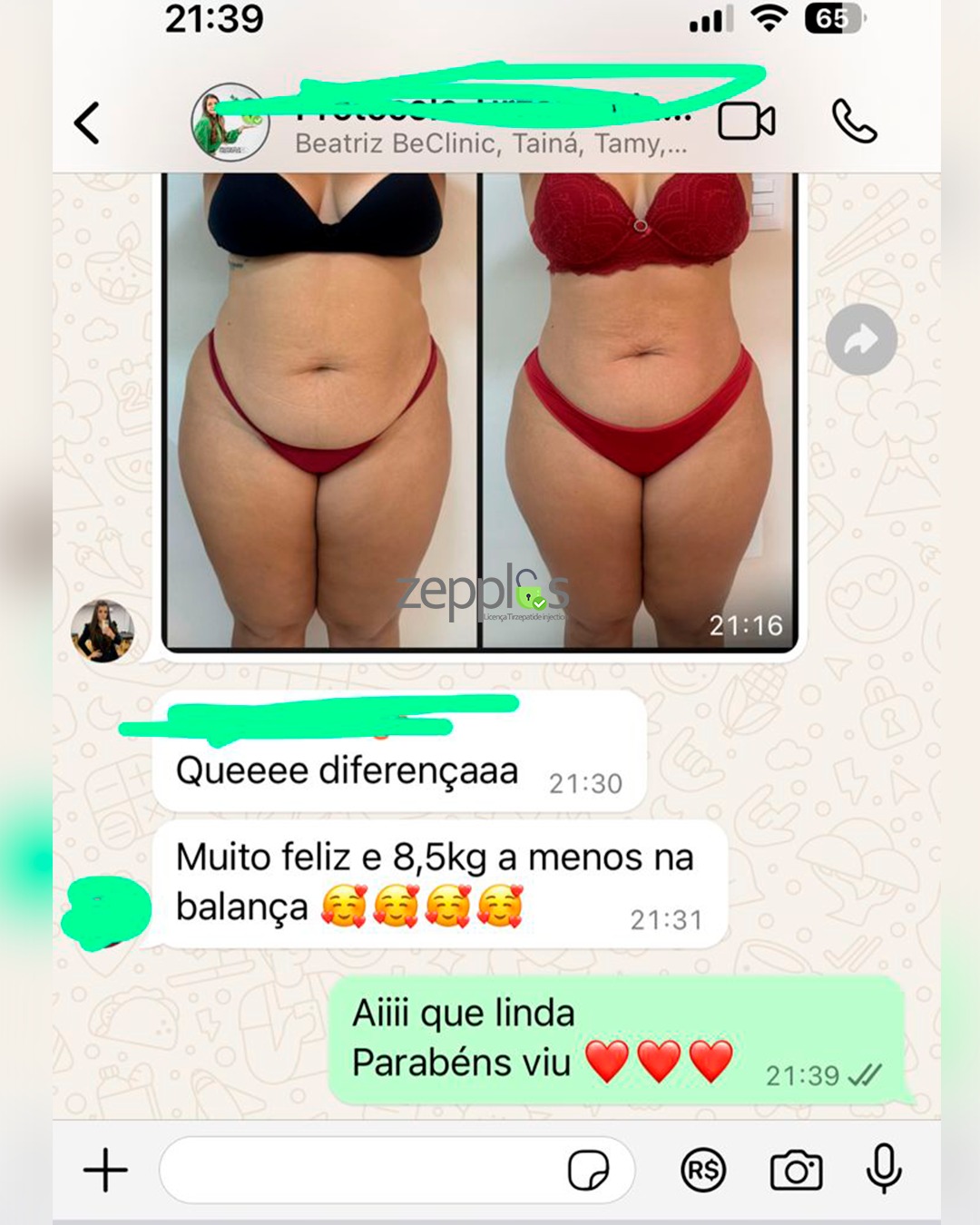 Antes e Depois Paciente 2