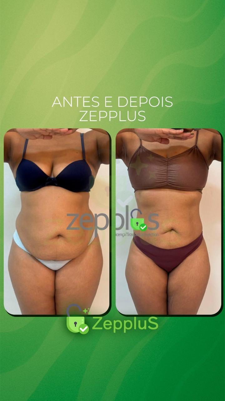 Antes e Depois Paciente 3
